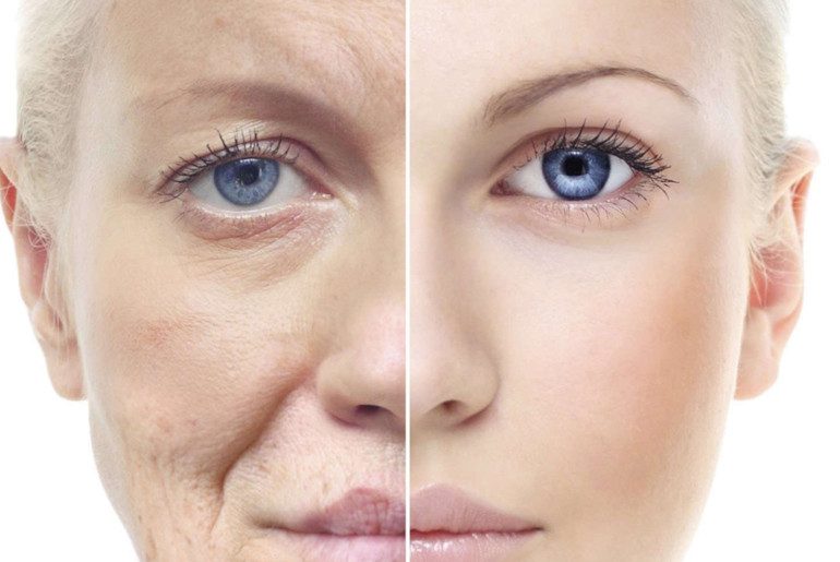 روند پیر شدن پوست