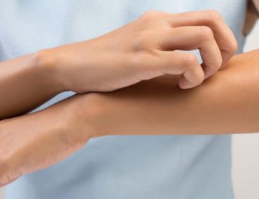 حساسیت های پوست و انواع آن