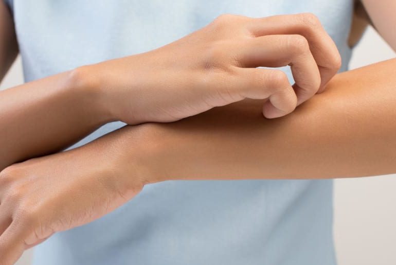 حساسیت های پوست و انواع آن