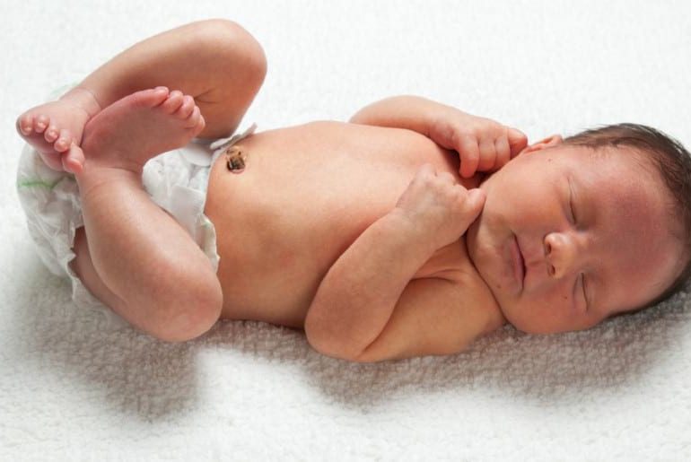 همه چیز در مورد بند ناف نوزاد همه چیز در مورد بند ناف نوزاد