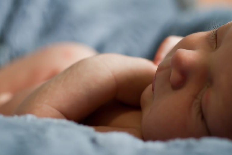 مشکلات شایع پوست نوزاد و راهکارهایی برای درمان مشکلات شایع پوست نوزاد و راهکارهایی برای درمان