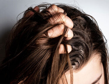 نکات مهم برای خرید شامپو مناسب پوست چرب